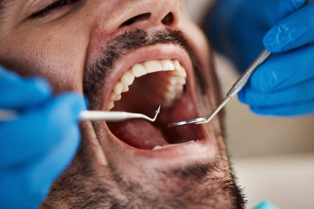 Best Dentist for Tooth Abscess  in Elm Springs, AR